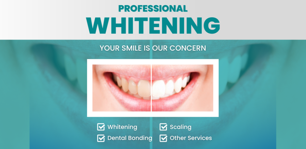 Teeth Whitening Procedures and their Effectiveness